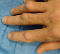 knuckle Pads